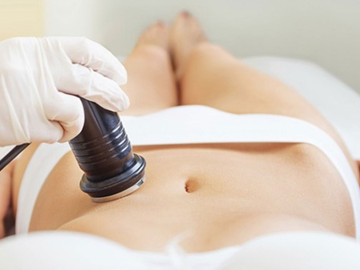 Body Contouring/CAV & RF